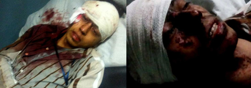 On January 20, 2016, a Taliban suicide bomber killed seven TOLO TV employees and injured 25 others, including me, as I was severely wounded.
Names of the deceased:
Jawad (Editor), Zainab (Dubbing Artist), Maryam (Dubbing Artist), Mohammadi (Dubbing Artist), Mehri (Creative Department Staff), Hossein (Decoration Department Staff), Kaka Hossein (Transport Department Staff)